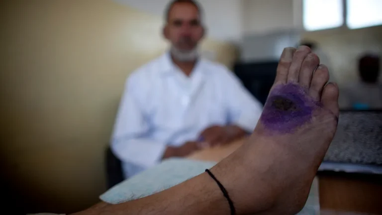 GettyImages-105483954