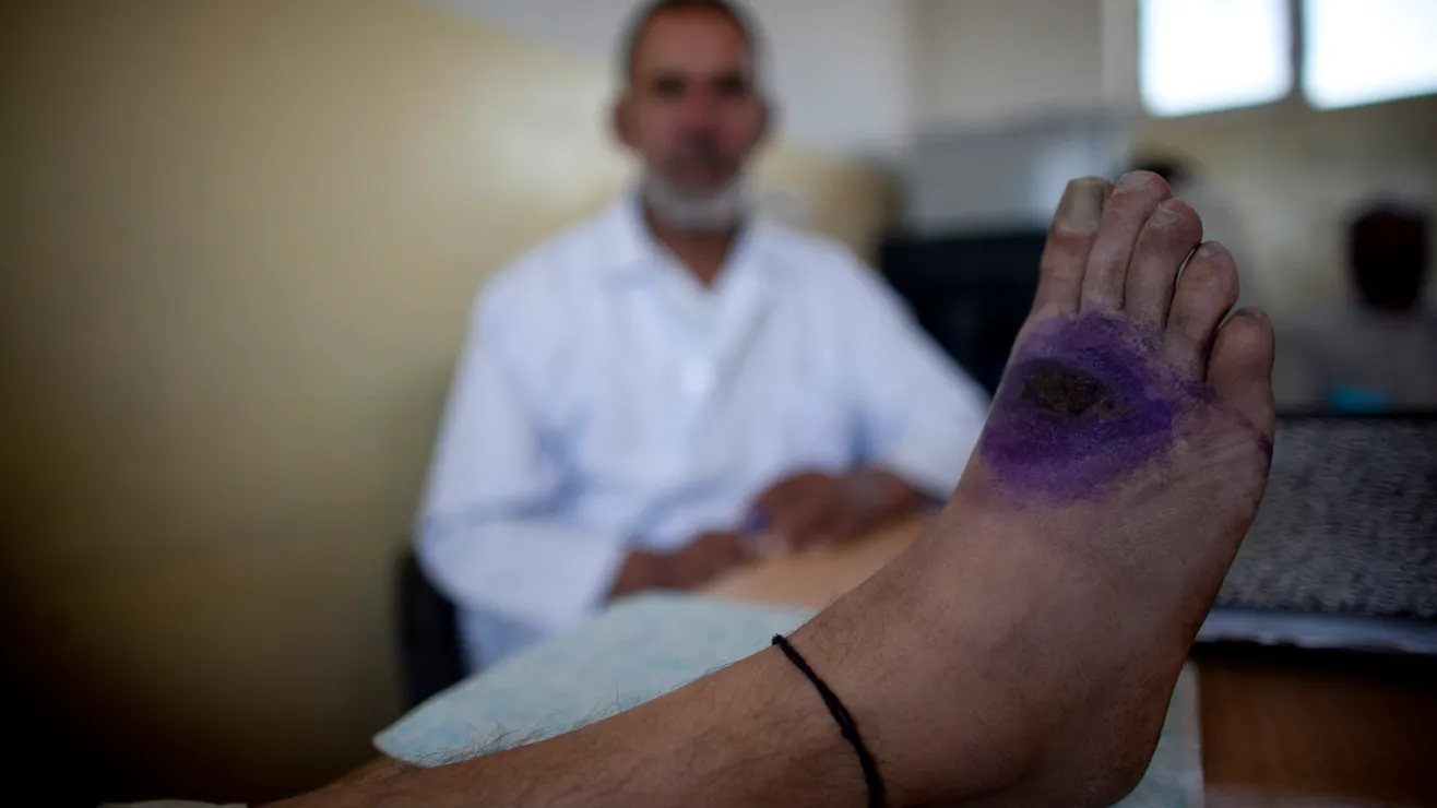 GettyImages-105483954