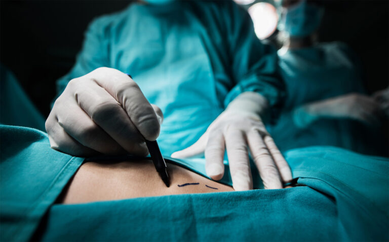 Los CDC revelan 93 pacientes de EEUU murieron