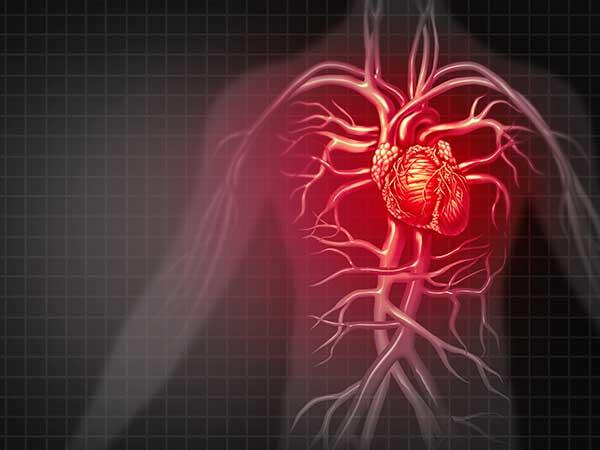 heart-attack-illustration-article