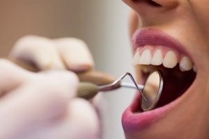 odontologia-preventiva